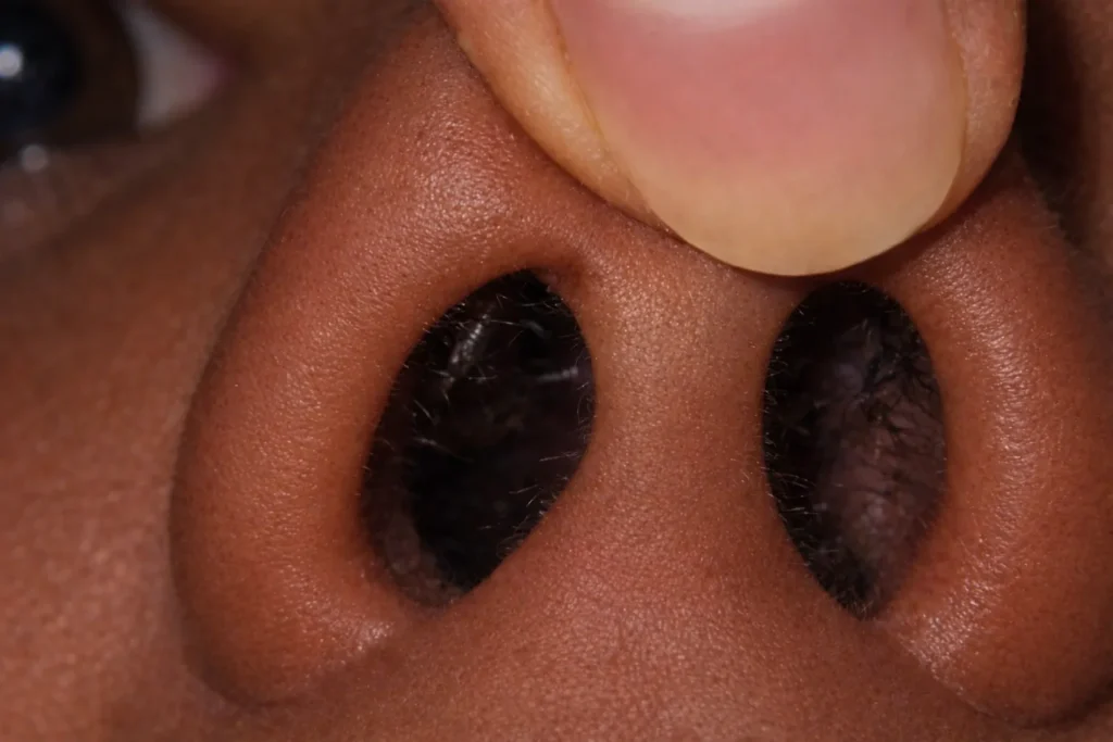 La razón científica por la que siempre respiramos más por un lado de la nariz